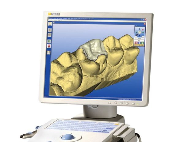 Dental Crown Troy, MI - Birmingham, MI - Bloomfield, MI - Cosmetic ...