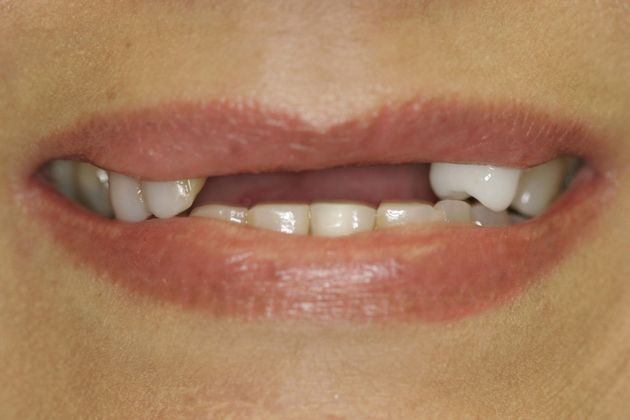 before dental treatment